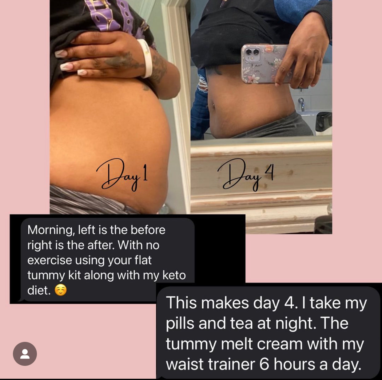 TummyMelt flat tummy cream